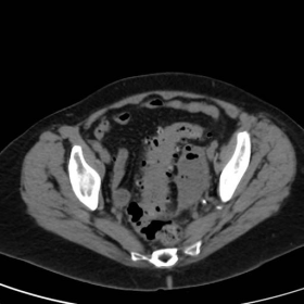 Initial contrast-enhanced MDCT examination
