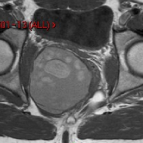 T1 weighted axial image