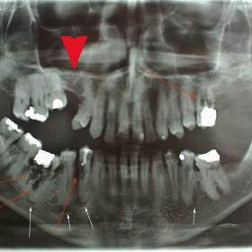 Orthopantomography