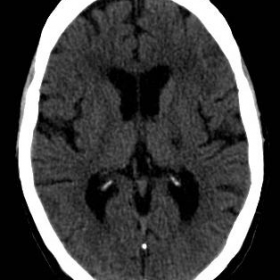 Initial CT images