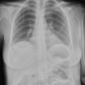 Plain radiographs of thorax and abdomen