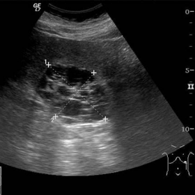 Ultrasound images
