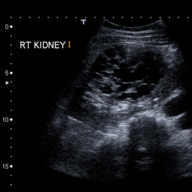 Longitudinal image of the right kidney
