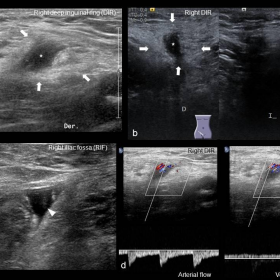 Ultrasound (US) image