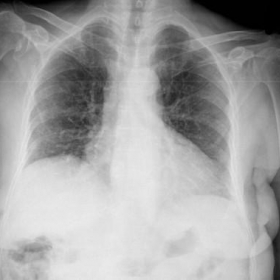 Plain radiographs of chest and abdomen