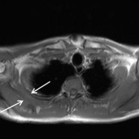 Axial T1-weighted MR image