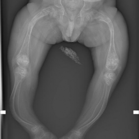 Plain X-ray of inferior limbs