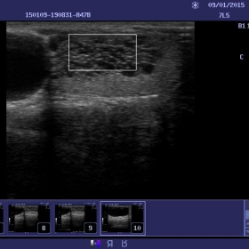 doppler ultrasound of the scrotum