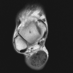 Axial T1 image