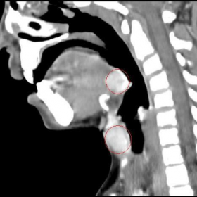 Sagittal CT image through midline