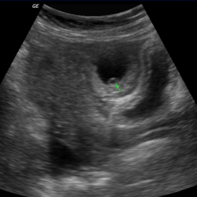 Ultrasound images