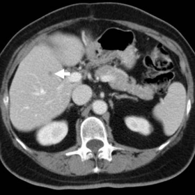 Preoperative contrast-enhanced total-body multidetector CT