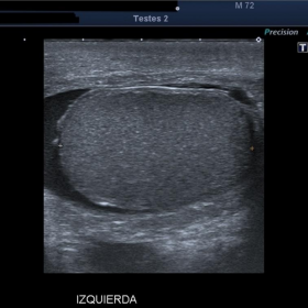 Ultrasound findings