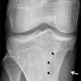 Anteroposterior radiograph of the right