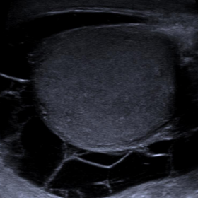 Grey-scale ultrasonographic findings