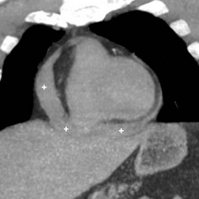 Emergency multidetector CT of thorax and abdomen