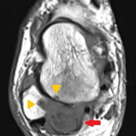 Axial T1-weighted image