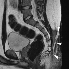MRI - T2-weighted images