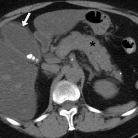 Urgent unenhanced and post-contrast multidetector CT at admission