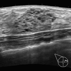 Fig. 1. Ultrasound