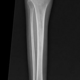 Conventional X-ray
