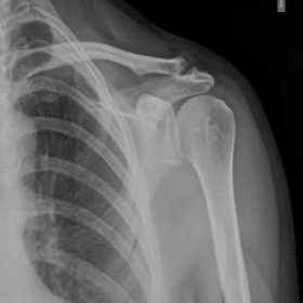 First radiograph