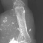 Finger X-ray